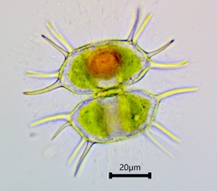 Xanthidium antilopaeum