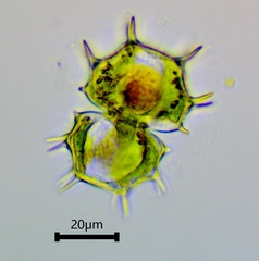 Xanthidium cristatum