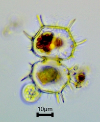 Xanthidium cristatum