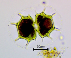 Xanthidium cristatum