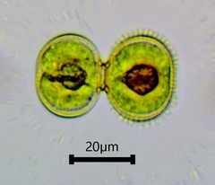 Cosmarium contractum