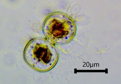 Cosmarium contractum