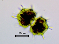 Xanthidium cristatum