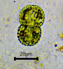 Cosmarium amoenum