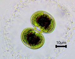 Cosmarium contractum