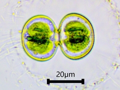 Cosmarium contractum