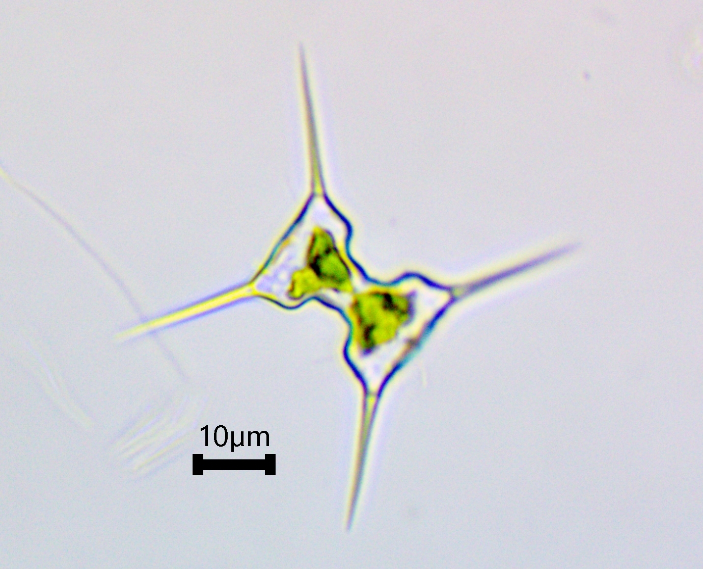 Staurodesmus extensus