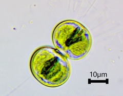 Cosmarium contractum