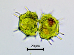 Xanthidium cristatum