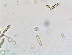 Anomoeoneis