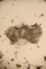 Physarum didermoides