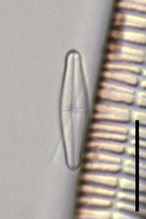 Achnanthidium minutissimum