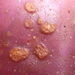 Streptomyces scabies - Photo (c) Dave Holland, algunos derechos reservados (CC BY-NC), subido por Dave Holland