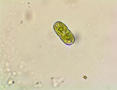 Desmidiaceae