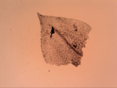 Eccremidium pulchellum