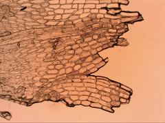 Eccremidium pulchellum