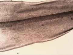 Syntrichia antarctica