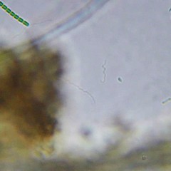 Spirochaetae
