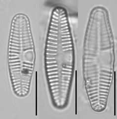 Planothidium lanceolatum