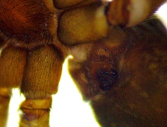 Varacosa