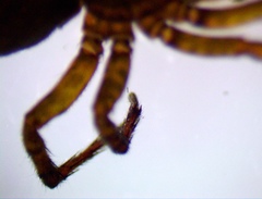 Varacosa