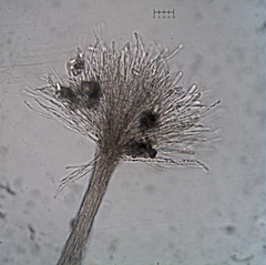 Atractium stilbaster