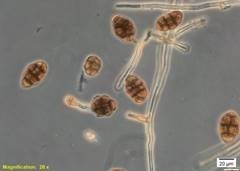 Alternaria radicina