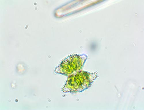 Staurastrum aculeatum — photo 1