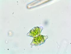 Staurastrum aculeatum