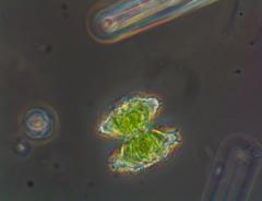 Staurastrum aculeatum