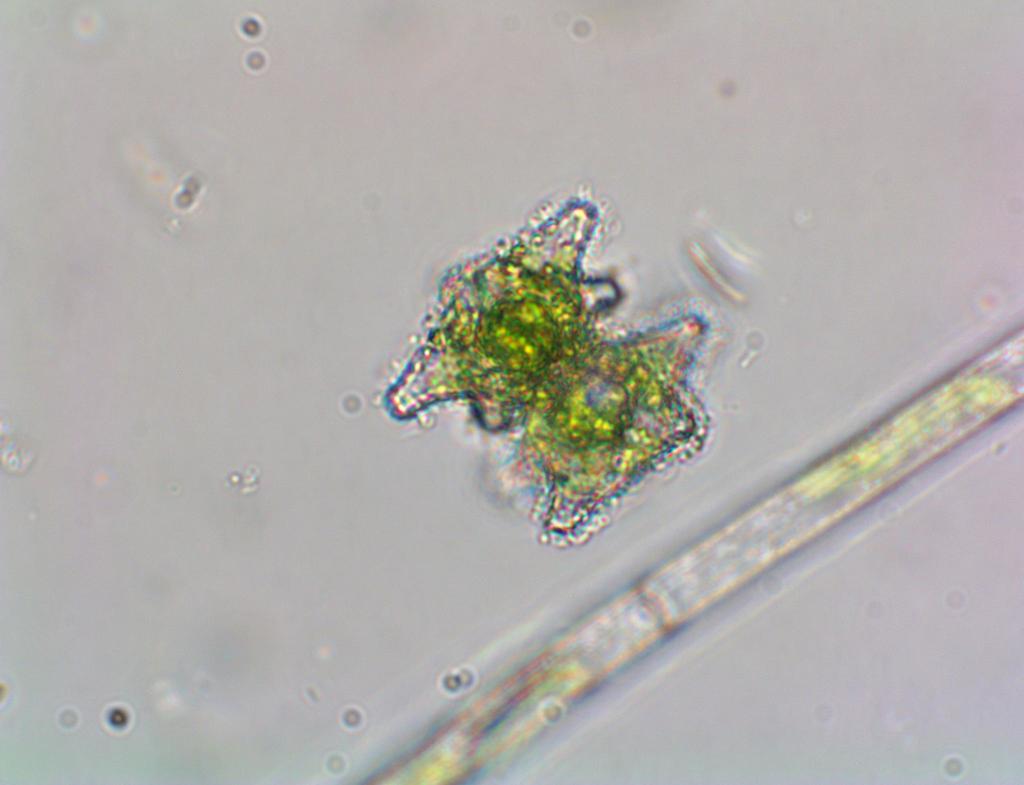 Staurastrum margaritaceum