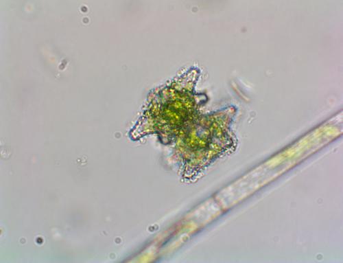 Staurastrum margaritaceum