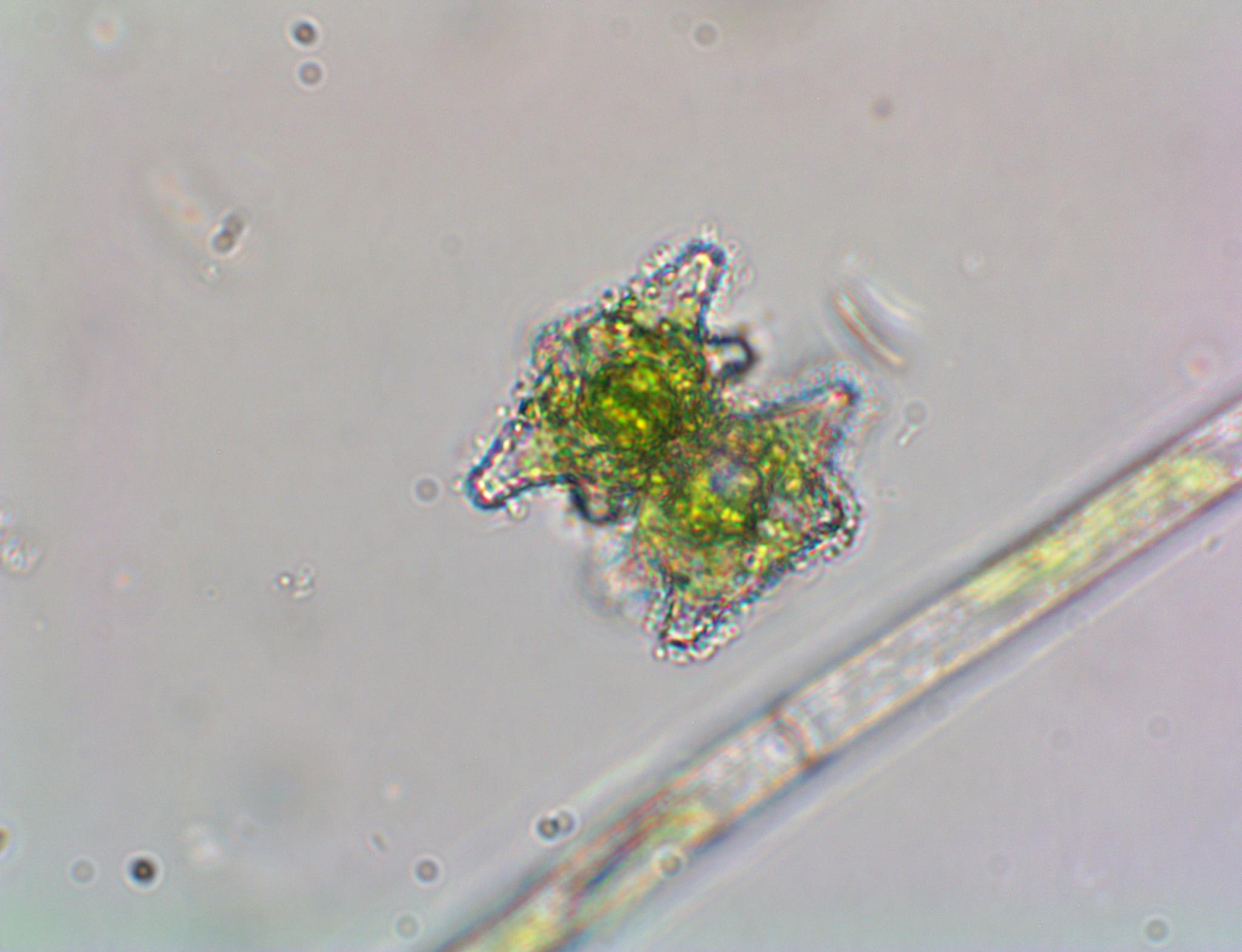 Staurastrum margaritaceum