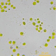 Asterococcus