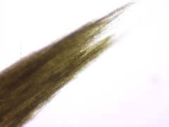 Aphanizomenon flosaquae