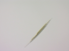 Aphanizomenon flosaquae