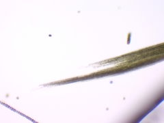 Aphanizomenon flosaquae