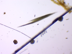 Aphanizomenon flosaquae
