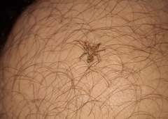 Araneae