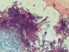 Scytinostroma incrustatum