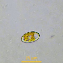 Cocconeis placentula