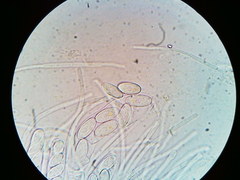 Ascobolus crenulatus