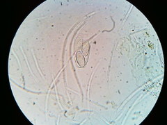 Ascobolus crenulatus