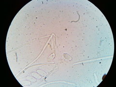 Ascobolus crenulatus