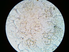 Ascobolus crenulatus