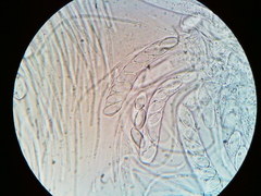 Ascobolus crenulatus