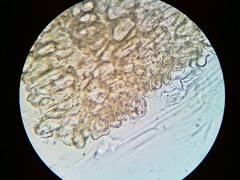 Ascobolus crenulatus