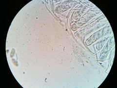 Ascobolus crenulatus