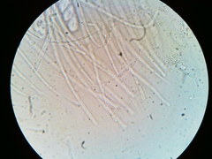 Ascobolus crenulatus