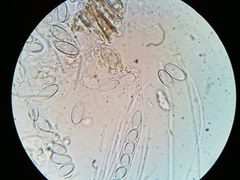 Ascobolus crenulatus